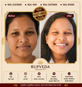 Rupveda Kumkumadi Facial Kit – Ayurvedic Glow Ritual for Tan, Pigmentation & Dull Skin