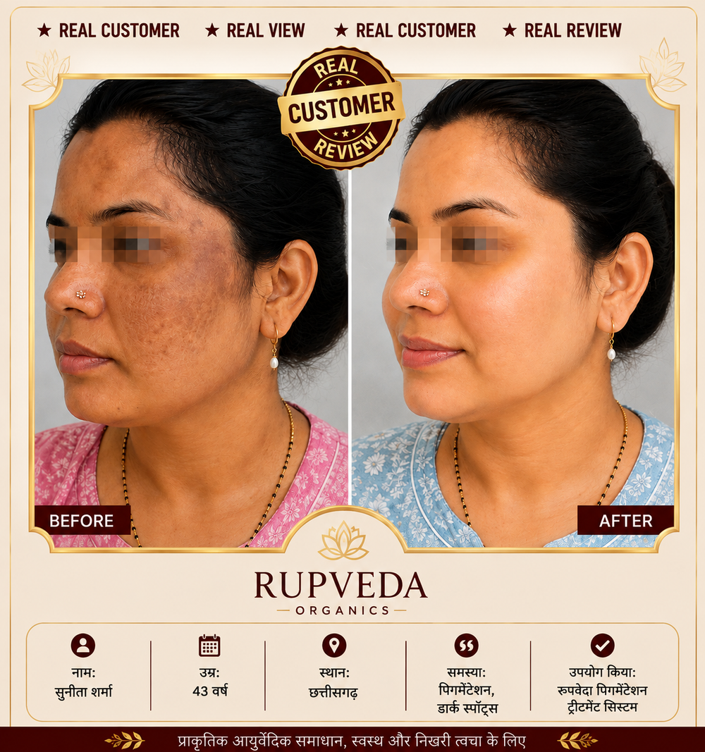 Rupveda Kumkumadi Facial Kit – Ayurvedic Glow Ritual for Tan, Pigmentation & Dull Skin