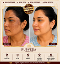 Rupveda Kumkumadi Facial Kit – Ayurvedic Glow Ritual for Tan, Pigmentation & Dull Skin