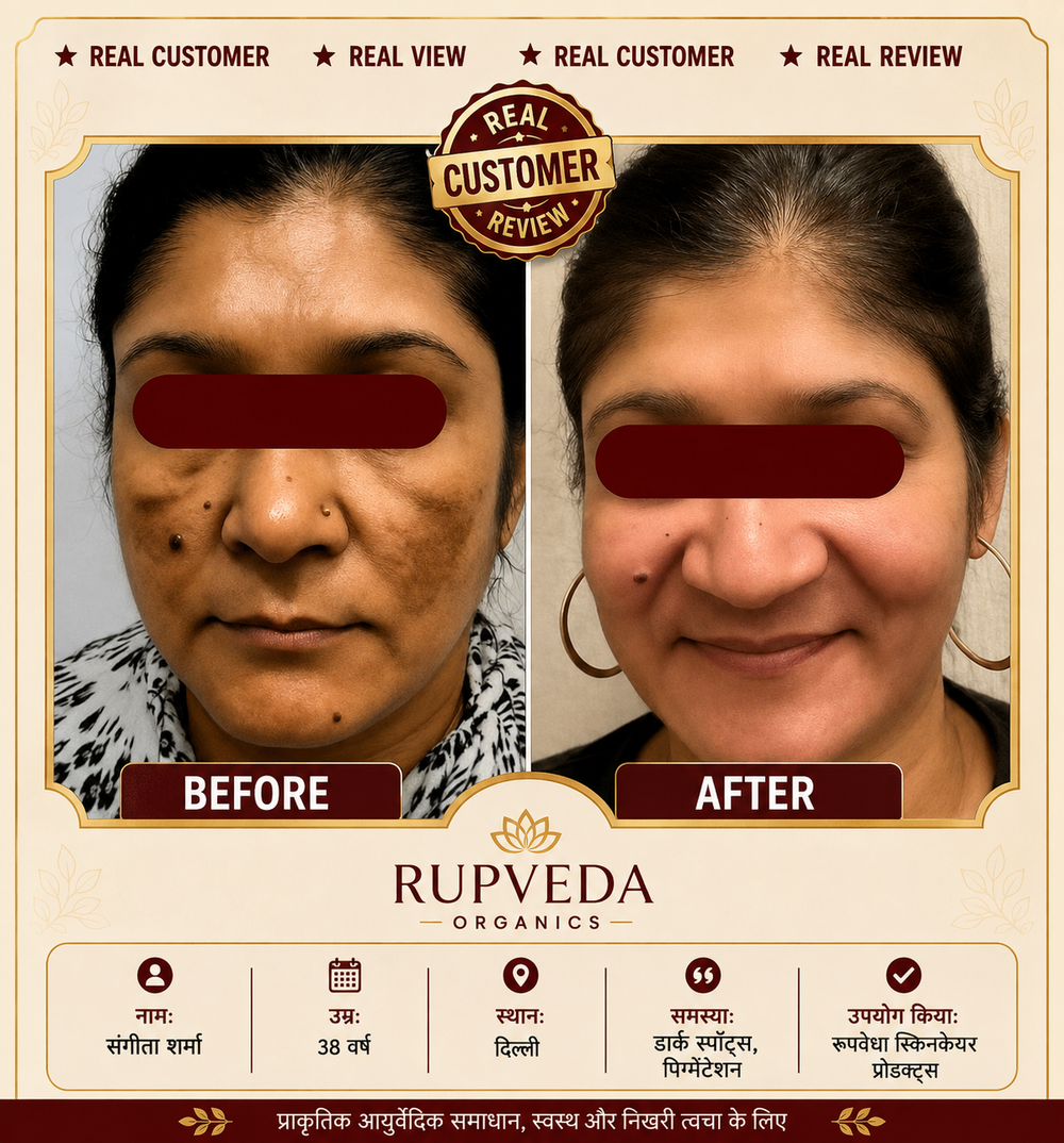 Rupveda Kumkumadi Facial Kit – Ayurvedic Glow Ritual for Tan, Pigmentation & Dull Skin