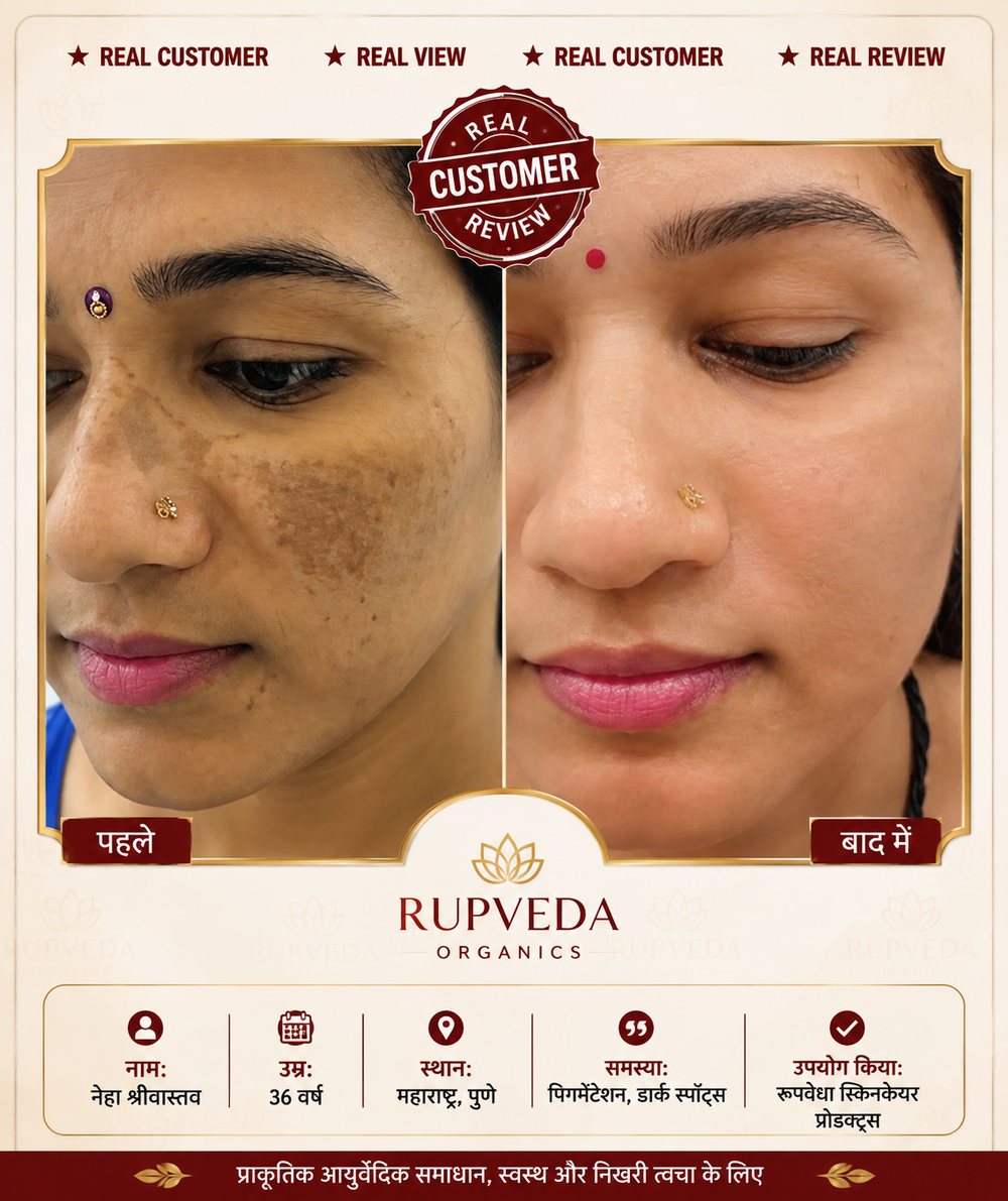 Rupveda Kumkumadi Facial Kit – Ayurvedic Glow Ritual for Tan, Pigmentation & Dull Skin