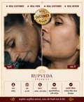 Rupveda Kumkumadi Facial Kit – Ayurvedic Glow Ritual for Tan, Pigmentation & Dull Skin