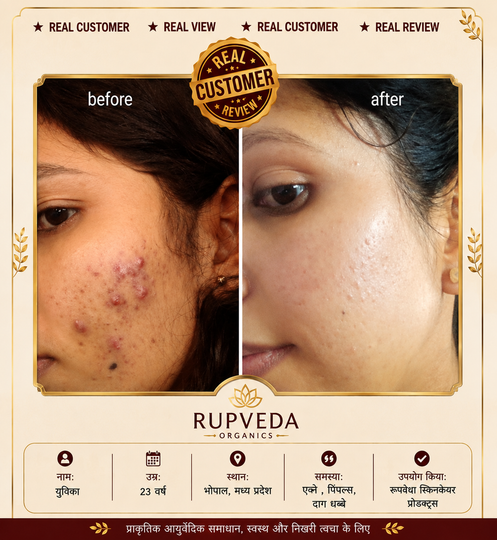 Rupveda Kumkumadi Facial Kit – Ayurvedic Glow Ritual for Tan, Pigmentation & Dull Skin