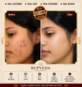 Rupveda Kumkumadi Facial Kit – Ayurvedic Glow Ritual for Tan, Pigmentation & Dull Skin