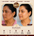 Rupveda Kumkumadi Facial Kit – Ayurvedic Glow Ritual for Tan, Pigmentation & Dull Skin